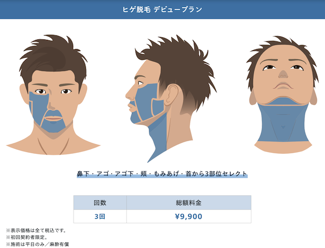 レジーナクリニックオムのデビュープラン画像