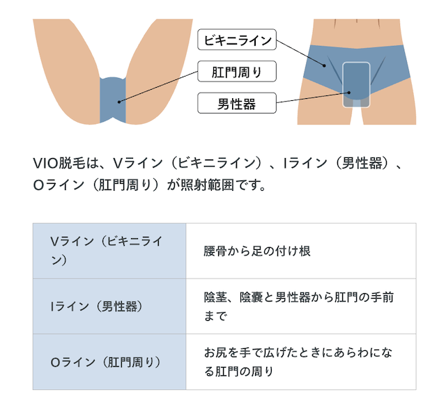 レジーナクリニックオムのVIO施術範囲