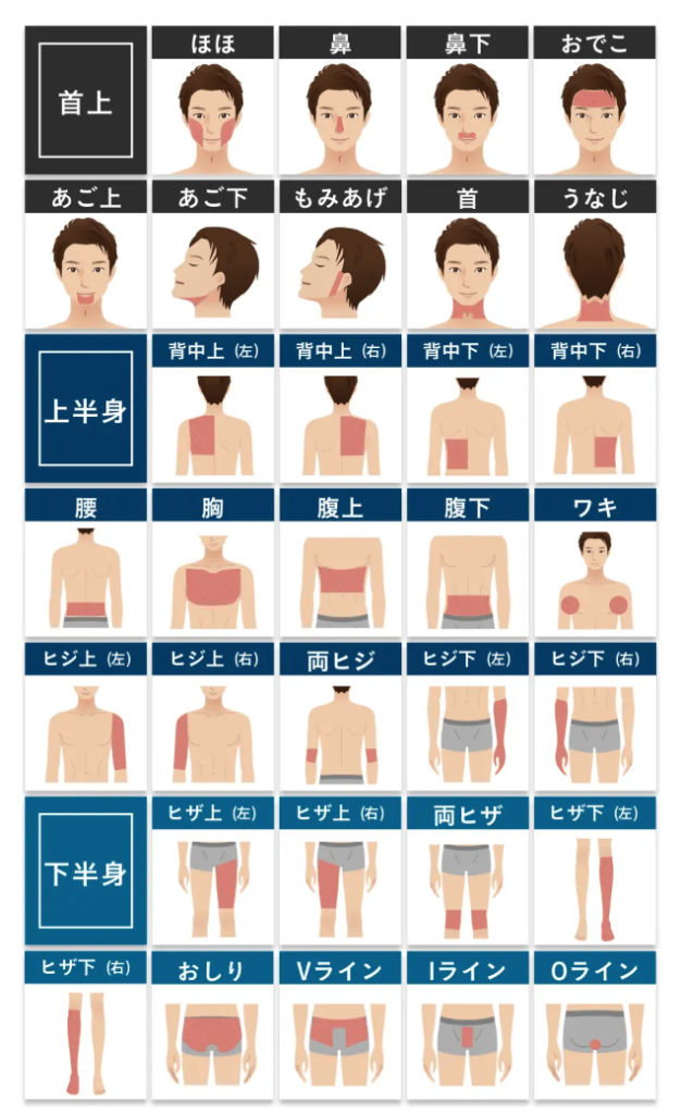 エミナルクリニックメンズの脱毛部位画像